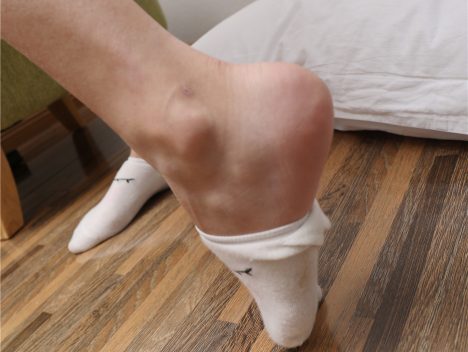 [MZSOCK]爱美足 No.032 虫子 [115P-1.37GB]